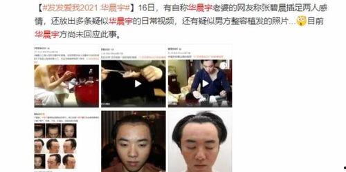 娱乐圈要谨慎吃瓜吗百度云,谨慎吃瓜,理性看待网络传闻 第2张 娱乐圈要谨慎吃瓜吗百度云,谨慎吃瓜,理性看待网络传闻 第2张